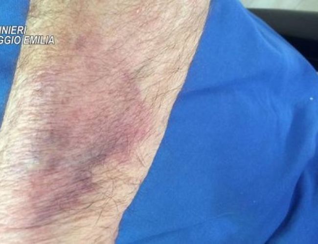 Correggio, anziani maltrattati in casa di riposo: la nostra condanna